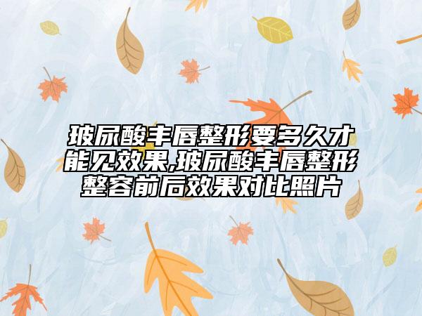 玻尿酸豐唇整形要多久才能見效果,玻尿酸豐唇整形整容前后效果對(duì)比照片