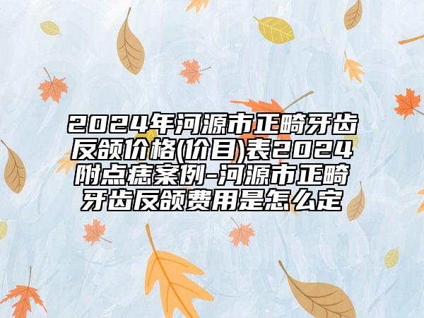 2024年河源市正畸牙齒反頜價(jià)格(價(jià)目)表2024附點(diǎn)痣案例-河源市正畸牙齒反頜費(fèi)用是怎么定