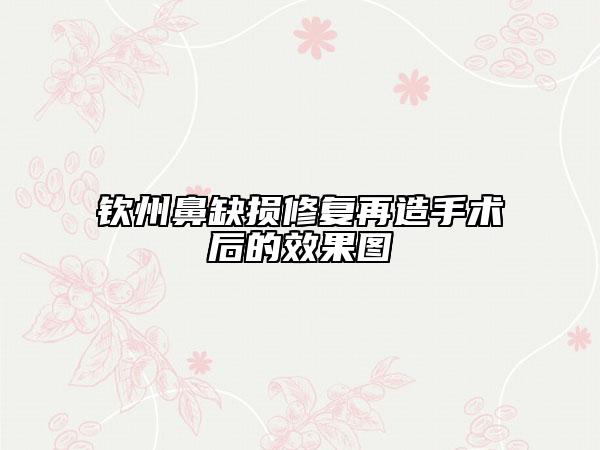 欽州鼻缺損修復(fù)再造手術(shù)后的效果圖