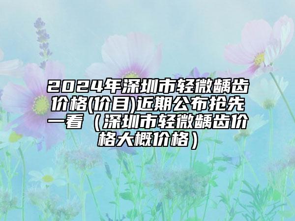 2024年深圳市輕微齲齒價(jià)格(價(jià)目)近期公布搶先一看（深圳市輕微齲齒價(jià)格大概價(jià)格）