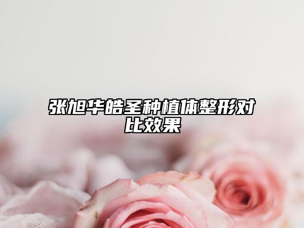 張旭華皓圣種植體整形對(duì)比效果